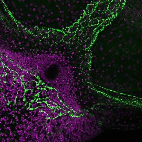 010_jellyfish_and_fruit_flies_shed_light_on_origin_hunger_regulation_fig2.jpg